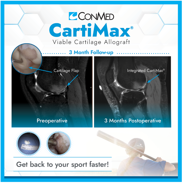 CartiMax