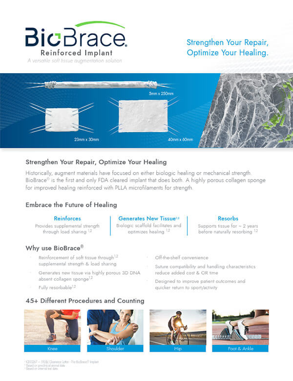 BioBrace Product Brochure