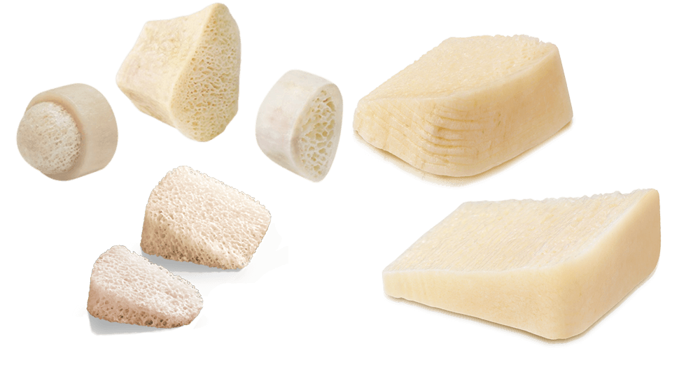 AlloAid Wedge Bone Collection