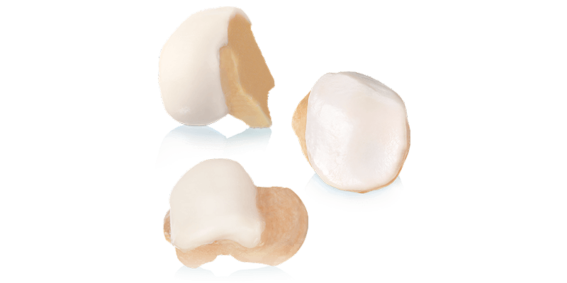 osteochondral allografts
