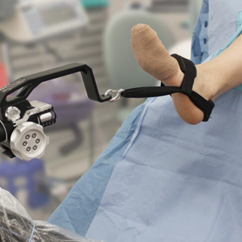 showing the AssistArm in the Ankle Arthroscopy position