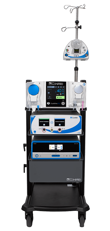 Arthroscopic Resection, FluidManagement and RF Ablation on Procedure Cart